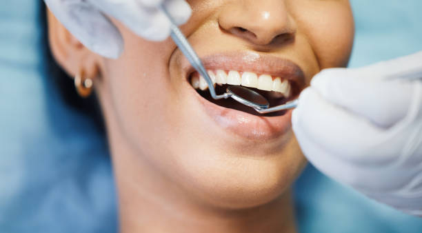 Best Emergency Denture Repair in West Union, OH