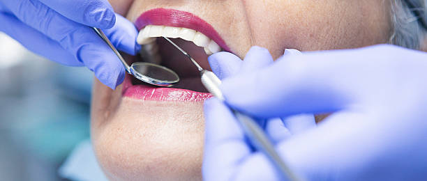 Best Emergency Treatment for Dental Infections or Abscesses in West Union, OH